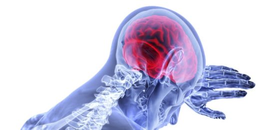 serangan stroke Metode FAST