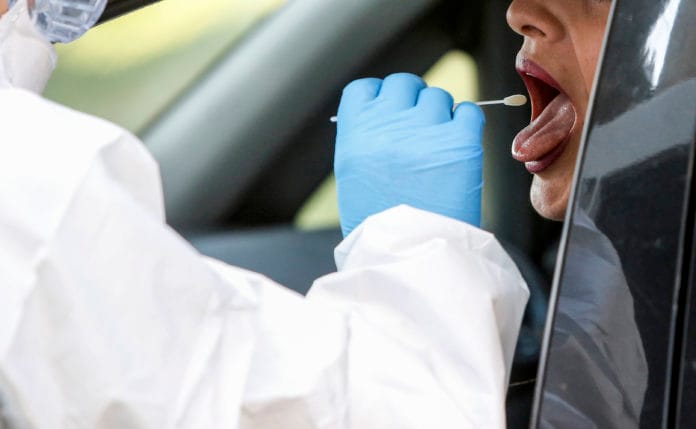 Swab tes Covid-19 Swab tes Covid-19. (Foto file - Anadolu Agency)