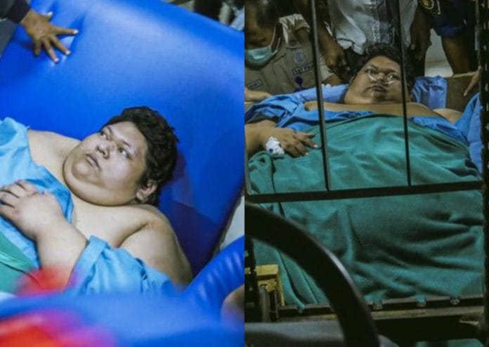 Nyesek! Begini Fakta Mengejutkan Pria Obesitas Bobot 300 Kg, yang Kini Dikabarkan Telah Meninggal Dunia