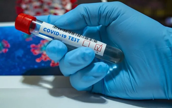 Kasus Covid-19 di Singapura Naik Tajam, Begini Imbauan Pemerintah Negeri Jiran