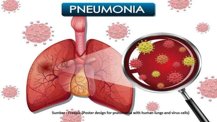 pneumonia